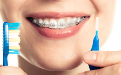 How often should i whiten my teeth